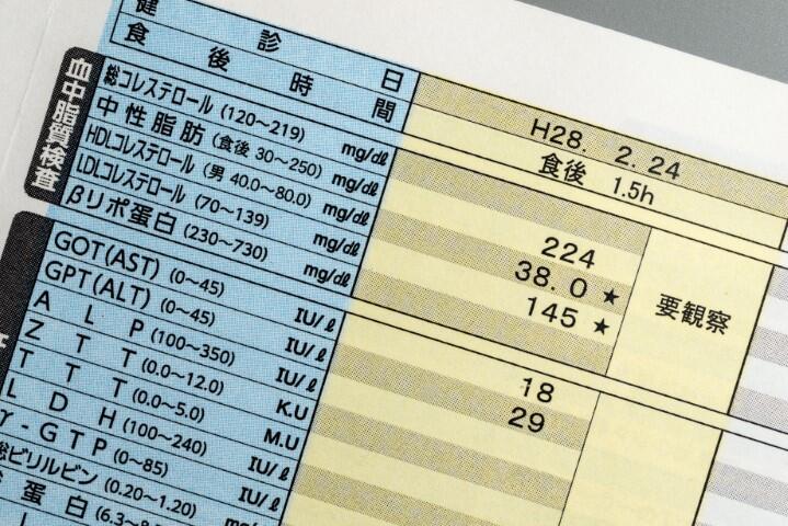 特定健診58.1％、特定保健指導26.5％　実施率過去最高に －2022年度の特定健診・特定保健指導実施状況より